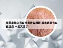 膝盖皮肤上有白点是什么原因 膝盖表面有白色斑点 一柔又没了