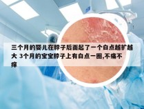 三个月的婴儿在脖子后面起了一个白点越扩越大 3个月的宝宝脖子上有白点一圈,不痛不痒