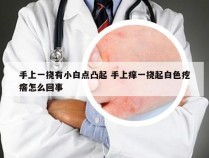 手上一挠有小白点凸起 手上痒一挠起白色疙瘩怎么回事