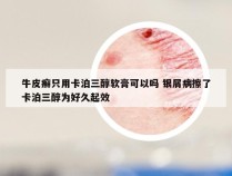 牛皮癣只用卡泊三醇软膏可以吗 银屑病擦了卡泊三醇为好久起效