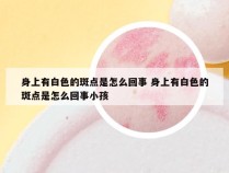 身上有白色的斑点是怎么回事 身上有白色的斑点是怎么回事小孩