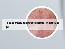 长春牛皮癣医院哪家较值得信赖 长春市治牛癣