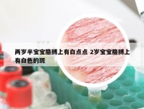 两岁半宝宝胳膊上有白点点 2岁宝宝胳膊上有白色的斑