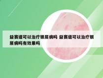 益赛谱可以治疗银屑病吗 益赛谱可以治疗银屑病吗有效果吗