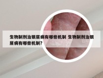 生物制剂治银屑病有哪些机制 生物制剂治银屑病有哪些机制?