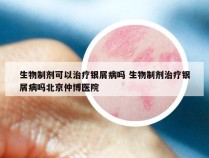 生物制剂可以治疗银屑病吗 生物制剂治疗银屑病吗北京仲博医院