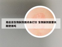 用应该生物制剂需终身打针 生物制剂需要长期使用吗