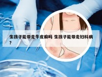 生孩子能带走牛皮癣吗 生孩子能带走妇科病?