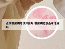 点滴银屑病可以汗蒸吗 银屑病能蒸桑拿泡澡吗