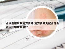 点滴型银屑病复方青黛 复方青黛丸配合什么药治疗银屑病最好