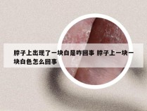 脖子上出现了一块白是咋回事 脖子上一块一块白色怎么回事