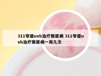 311窄谱uvb治疗银屑病 311窄谱uvb治疗银屑病一周几次