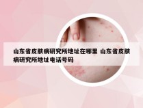 山东省皮肤病研究所地址在哪里 山东省皮肤病研究所地址电话号码