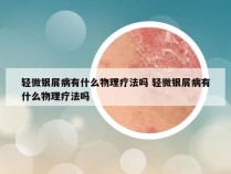 轻微银屑病有什么物理疗法吗 轻微银屑病有什么物理疗法吗