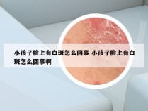 小孩子脸上有白斑怎么回事 小孩子脸上有白斑怎么回事啊