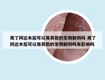 用了阿达木后可以用其他的生物制剂吗 用了阿达木后可以用其他的生物制剂吗有影响吗