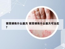 银霄病有什么偏方 银霄病有什么偏方可治愈?