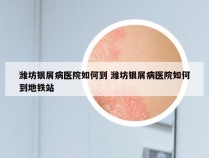 潍坊银屑病医院如何到 潍坊银屑病医院如何到地铁站