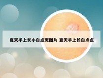 夏天手上长小白点斑图片 夏天手上长白点点