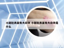 小腿肚表面有大白块 小腿肚表面有大白块是什么