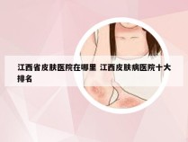 江西省皮肤医院在哪里 江西皮肤病医院十大排名