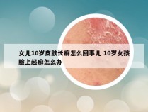 女儿10岁皮肤长癣怎么回事儿 10岁女孩脸上起癣怎么办