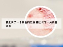 腰上长了一个白色的斑点 腰上长了一片白色斑点