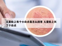 儿童脸上有个小白点是怎么回事 儿童脸上长了个白点