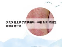 少女叉腿上长了皮肤癣吗一种什么膏 叉腿怎么读音是什么