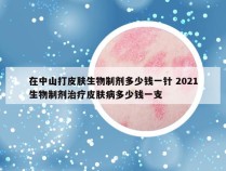 在中山打皮肤生物制剂多少钱一针 2021生物制剂治疗皮肤病多少钱一支