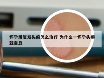 怀孕后复发头癣怎么治疗 为什么一怀孕头癣就自愈