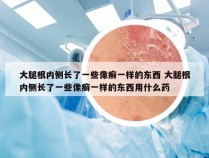 大腿根内侧长了一些像癣一样的东西 大腿根内侧长了一些像癣一样的东西用什么药