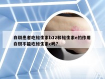 白斑患者吃维生素b12和维生素e的作用 白斑不能吃维生素c吗?