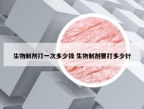 生物制剂打一次多少钱 生物制剂要打多少针