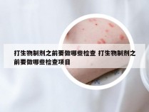 打生物制剂之前要做哪些检查 打生物制剂之前要做哪些检查项目