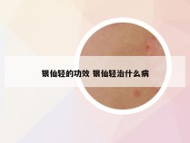 银仙轻的功效 银仙轻治什么病