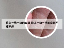 脸上一块一块的白斑 脸上一块一块的白斑不痛不痒