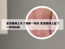 宝宝胳膊上长了像癣一样的 宝宝胳膊上起了一块块的癣