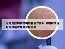 治疗皮肤病生物制剂有副作用吗 生物制剂治疗皮肤病对身体有伤害吗