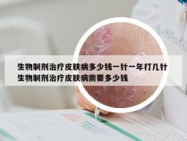 生物制剂治疗皮肤病多少钱一针一年打几针 生物制剂治疗皮肤病需要多少钱