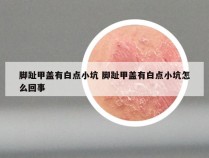 脚趾甲盖有白点小坑 脚趾甲盖有白点小坑怎么回事