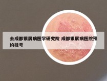 去成都银屑病医学研究院 成都银屑病医院预约挂号