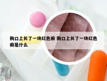 胸口上长了一块红色癣 胸口上长了一块红色癣是什么