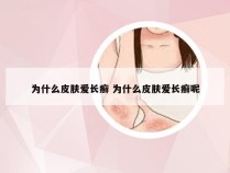 为什么皮肤爱长癣 为什么皮肤爱长癣呢