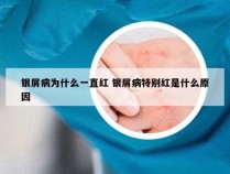 银屑病为什么一直红 银屑病特别红是什么原因