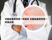 大腿后面突然有一块变白 大腿后面突然有一块变白斑