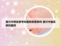 嘉兴中研皮肤专科医院收费贵吗 嘉兴中医皮肤科医院