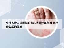 小孩儿身上像癣似的有几块是什么东西 孩子身上起的像癣