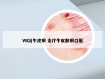 VB冶牛皮癣 治疗牛皮肤癣口服