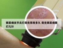 银屑病关节炎打类克得用多久 类克银屑病要打几针